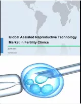 Global Assisted Reproductive Technology Market in Fertility Clinics 2017-2021